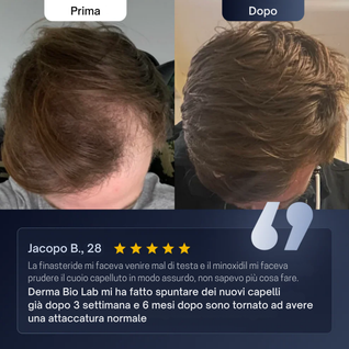 Siero Roll-on ricrescita capelli